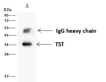 Polyclonal Rabbit anti-Human Rhodanese / TST Antibody (IHC, IF, WB)