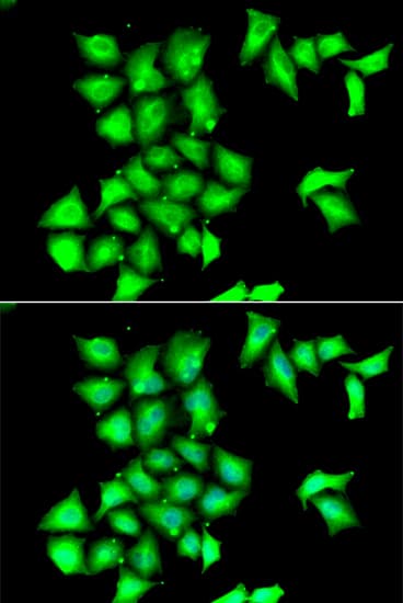 SEPX1 / Selenoprotein R Antibody