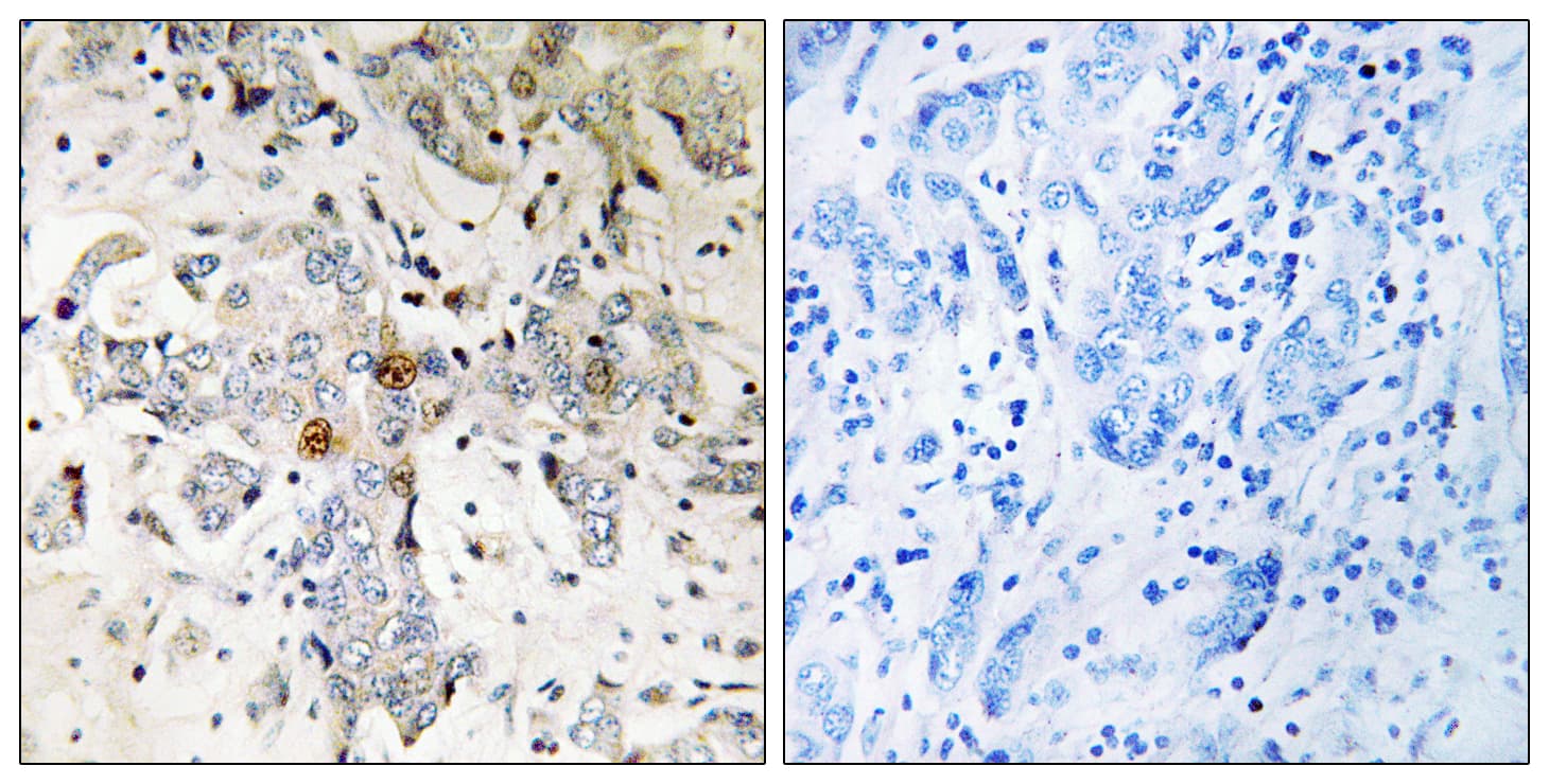 ZCCHC17 / PNO40 / PS1D Antibody (aa51-100)