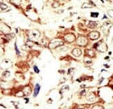 INSRR Antibody (aa1256-1287)