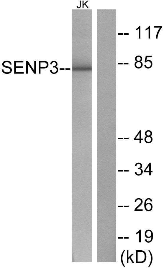 Polyclonal Rabbit anti-Human SENP3 Antibody (IHC, WB)