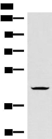 HMBOX1 Antibody