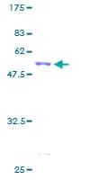 Human CA1 / Carbonic Anhydrase I Protein (Recombinant GST)
