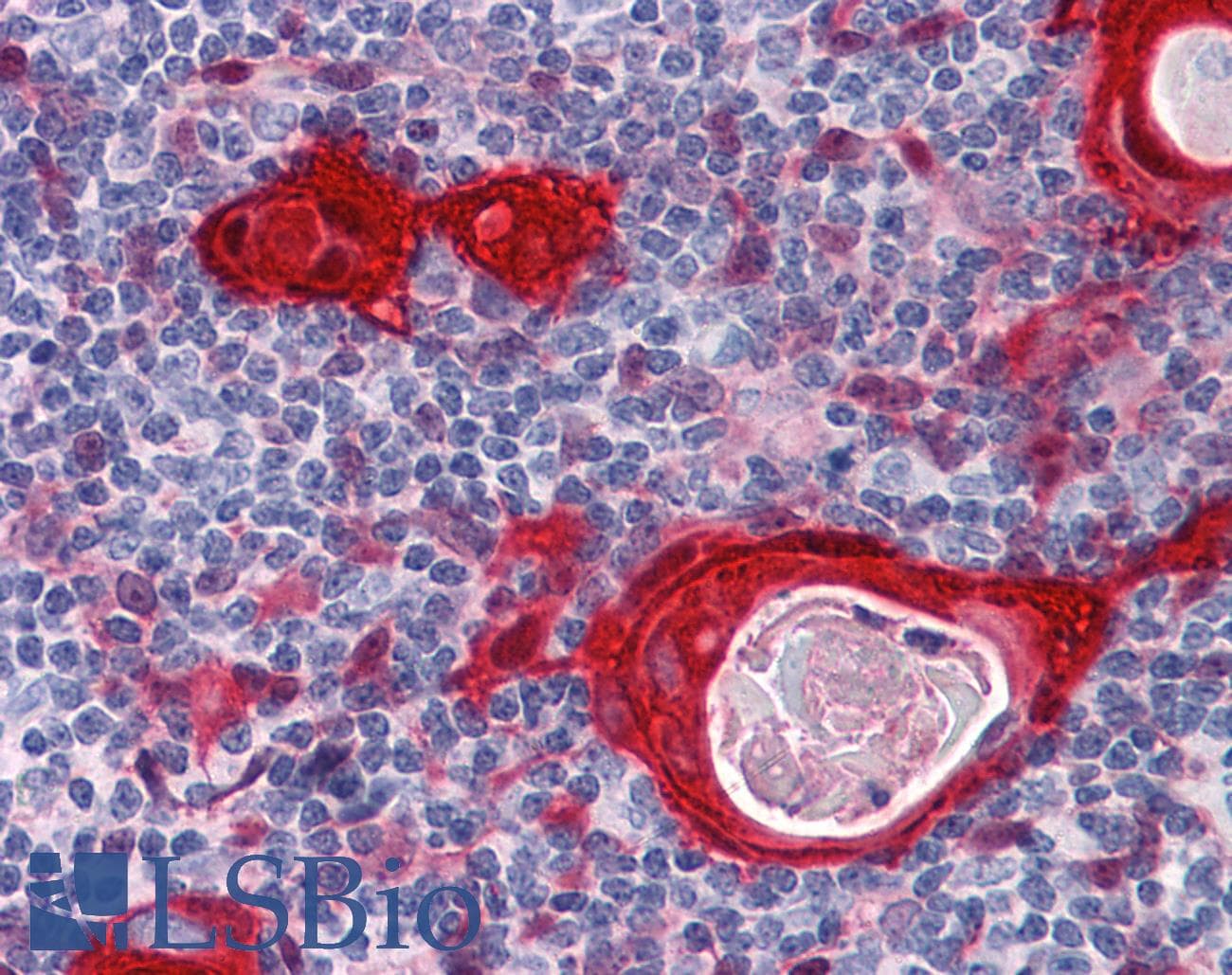 IHC-plus™ Monoclonal Mouse anti-Human SFN / Stratifin / 14-3-3 Sigma Antibody (clone 3C3, IHC, WB)