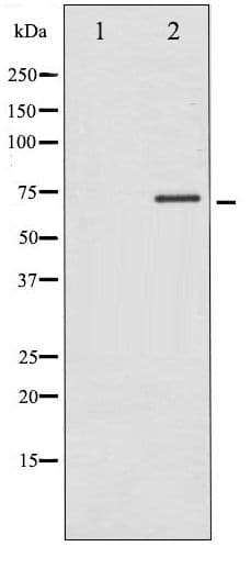 RPS6KB1 / P70S6K / S6K Antibody (phospho-Thr389/412)