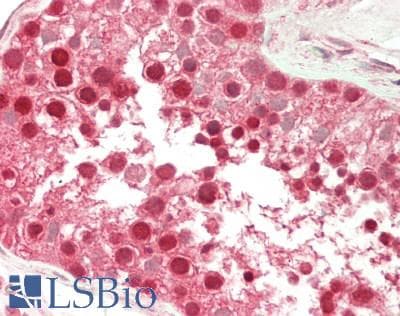 IHC-plus™ TIGAR Antibody (aa25-75)