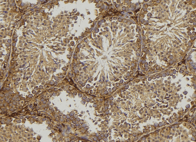 MPZ / P0 Antibody