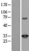 UCK1 Protein (Over-Expression Lysate Myc-DDK (Flag))