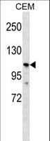 PKD2L1 Antibody (aa37-65)