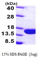 Human PVALB / Parvalbumin Protein (Recombinant His)