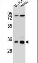 MTHFD2L Antibody (aa274-302)