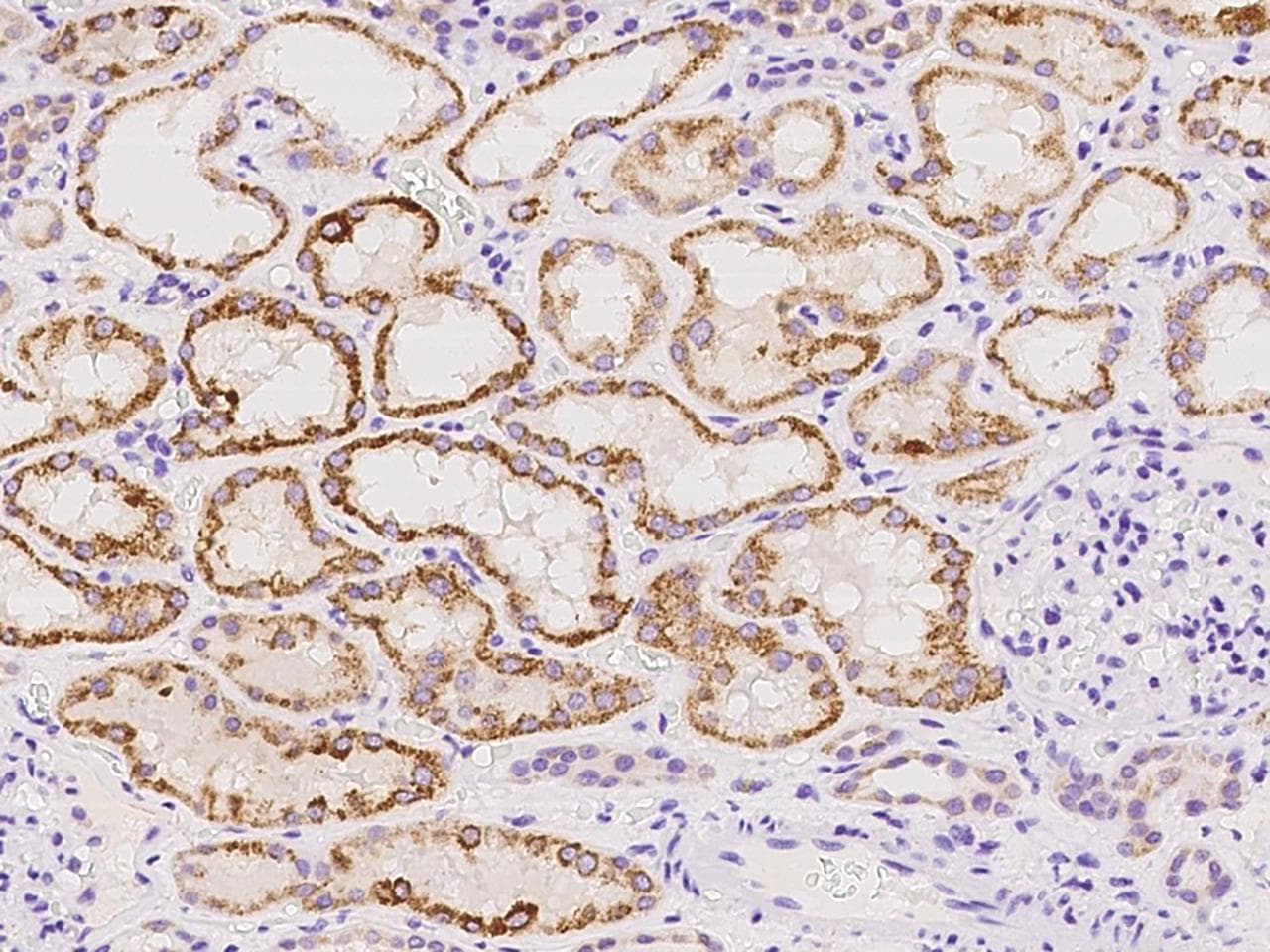 Polyclonal Rabbit anti-Human DHRS4 / PSCD Antibody (IHC, WB)