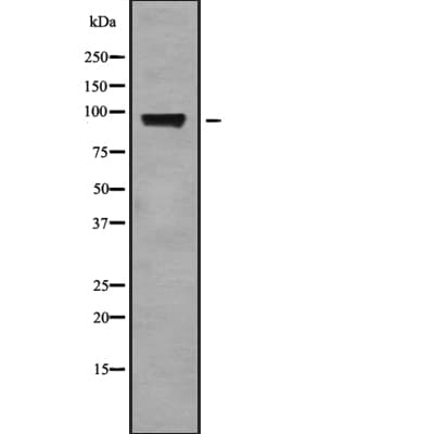 Polyclonal Rabbit anti-Human ELP2 / STATIP1 Antibody (IHC, IF, WB)