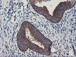PFKP Antibody (clone OTI2E10)