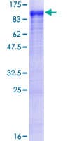 Human TARS Protein (Recombinant GST)