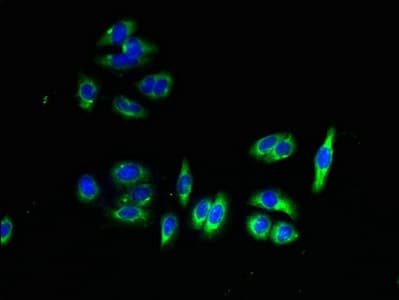 Polyclonal Rabbit anti-Human PAQR7 / mSR Antibody
