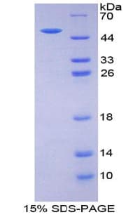 Human EPO / Erythropoietin Protein (Recombinant His-GST)