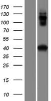 CCDC159 Protein (Over-Expression Lysate Myc-DDK (Flag))