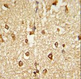 Polyclonal Rabbit anti-Human DLX2 Antibody (aa194-222, IHC, WB)