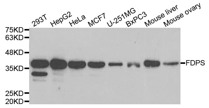 FDPS Antibody