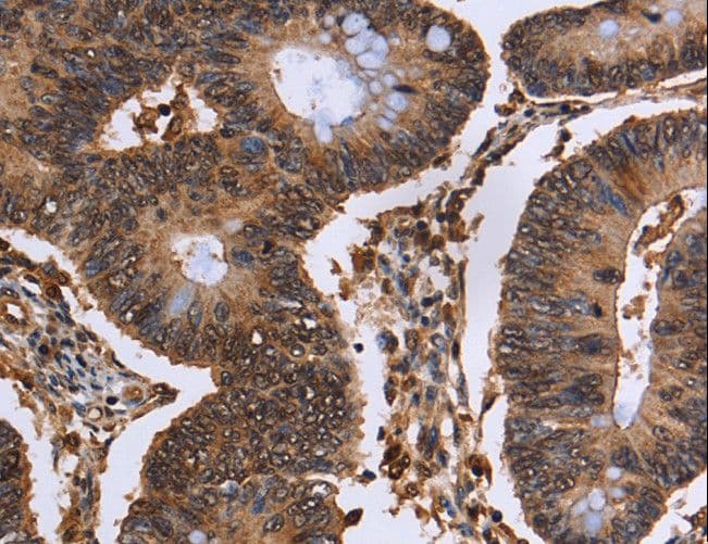 EXTL3 Antibody