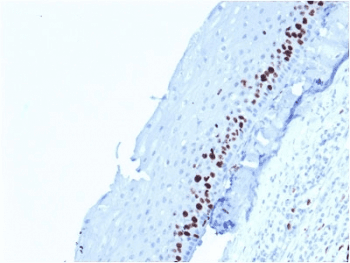 MKI67 / Ki67 Antibody (clone MKI67/2462)
