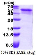 Human NEIL1 Protein (Recombinant His)