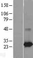 RAB25 Protein (Over-Expression Lysate Myc-DDK (Flag))