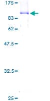 Human ORC2L / ORC2 Protein (Recombinant GST)