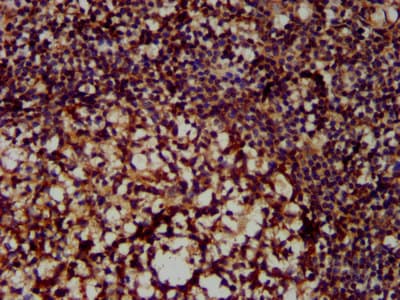 Polyclonal Rabbit anti-Human MX2 Antibody (IHC, IF)