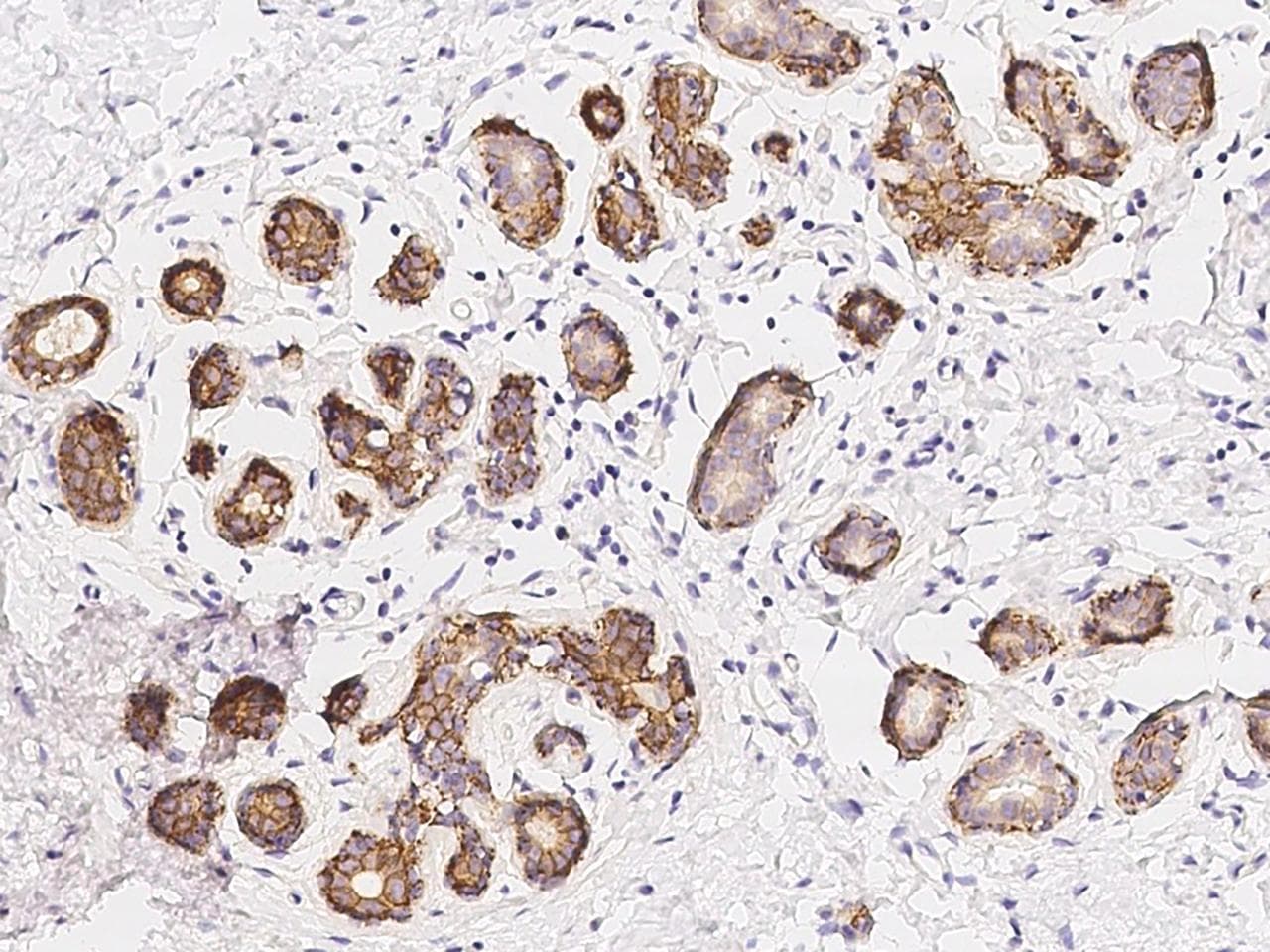 ERBB2 / HER2 Antibody (clone 40, Preservative Free)