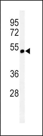 CHRNA3 Antibody (aa25-52)