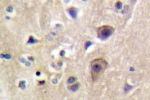 RYR2 / Ryanodine Receptor 2 Antibody (Asn2802)