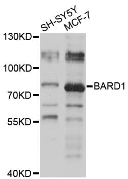 Polyclonal Rabbit anti-Mouse BARD1 Antibody (WB)