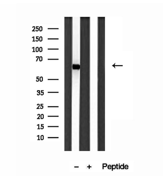 Polyclonal Rabbit anti-Human SESN2 / HI95 Antibody (aa335-359, IHC, WB)