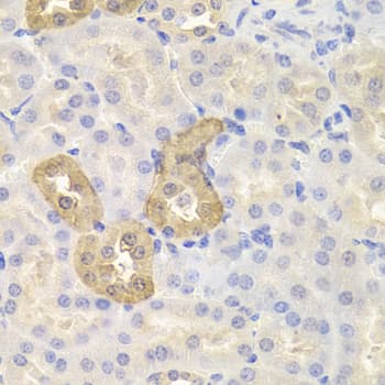 CHAF1B / CAF1 Antibody