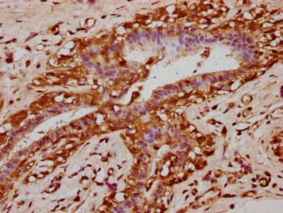 Polyclonal Rabbit anti-Human KLB / Beta Klotho Antibody (IHC)