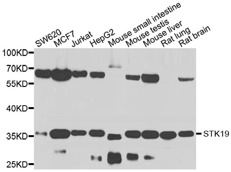 Polyclonal Rabbit anti-Human STK19 Antibody (IF, WB)