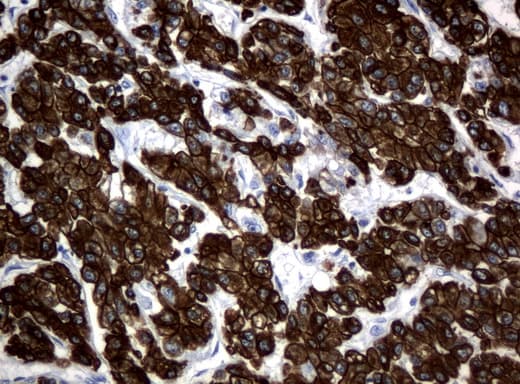 Monoclonal Mouse anti-Human KRT18 / CK18 / Cytokeratin 18 Antibody (clone UMAB50, Carrier-free, aa69-372, IHC, IF, WB)