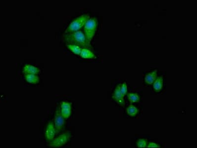 CTLA4 / CD152 Antibody