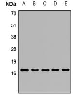 PRDX5 / Peroxiredoxin 5 Antibody