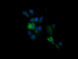 KLK8 / Kallikrein 8 Antibody (clone OTI5B1)