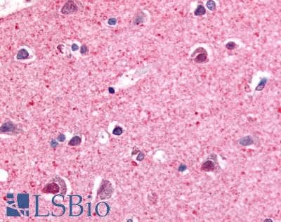 PathPlus™ Nor-1 / NR4A3 Antibody (Modulating Domain)