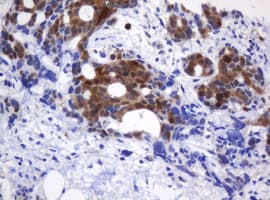 CMPK / CMPK1 Antibody (clone OTI2A2)