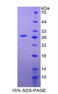 Mouse GLUD1/Glutamate Dehydrogenase Protein (Recombinant His-T7)