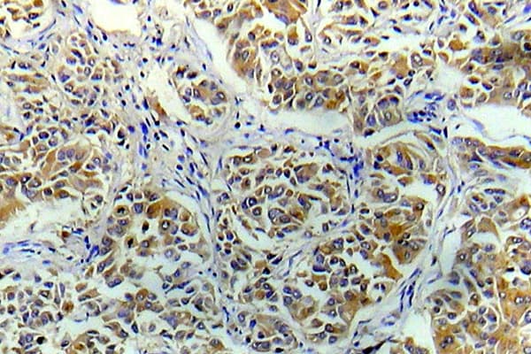 EIF4E Antibody (Arg215)