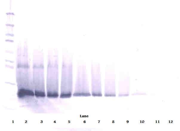 IFN Beta / Interferon Beta Antibody