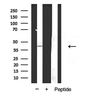 LPAR1 / LPA1 / EDG2 Antibody