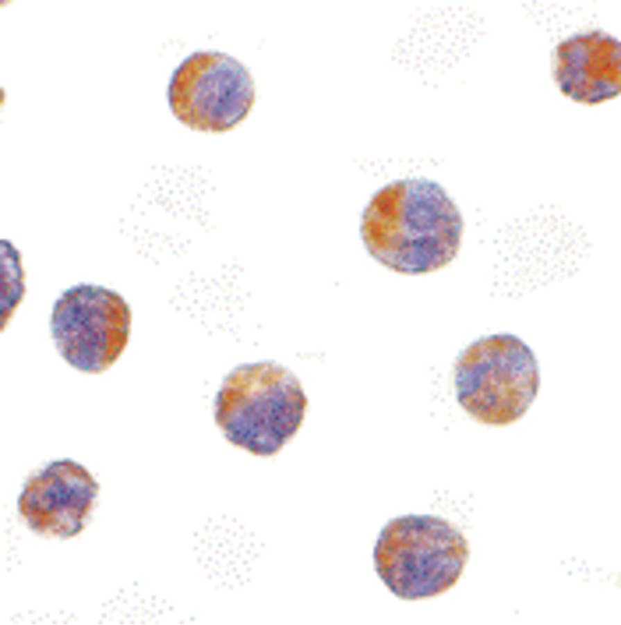 TICAM2 / TRAM Antibody