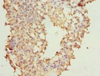 Polyclonal Rabbit anti-Human NUDT2 Antibody (IHC)
